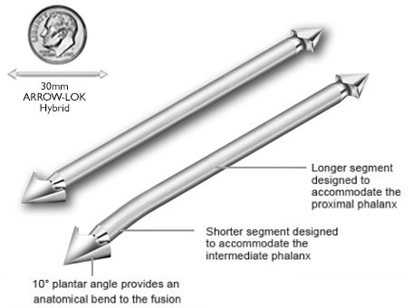 Arrow-lok product photo illustration.